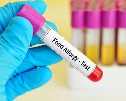 تحذير من فحوصات حساسية 